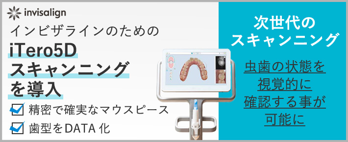 インビザラインのためのiTero5Dスキャンニングを導入